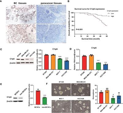 C1ql4 regulates breast cancer cell stemness and epithelial-mesenchymal transition through PI3K/AKT/NF-κB signaling pathway